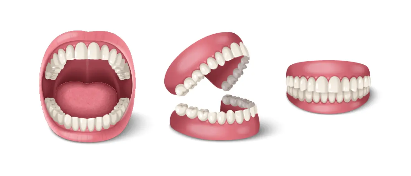 implant2